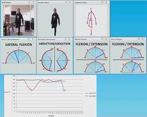 Les mouvements des os du patient sont reproduits à l’ordinateur grâce au capteur Kinect