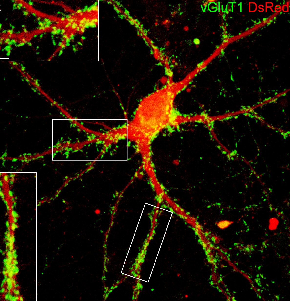 Neurone glutamatergique induit (en rouge) à partir d'une cellule gliale, muni de protéines de recapture (en vert)