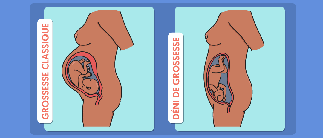 Comment expliquer le phénomène du déni de grossesse ...