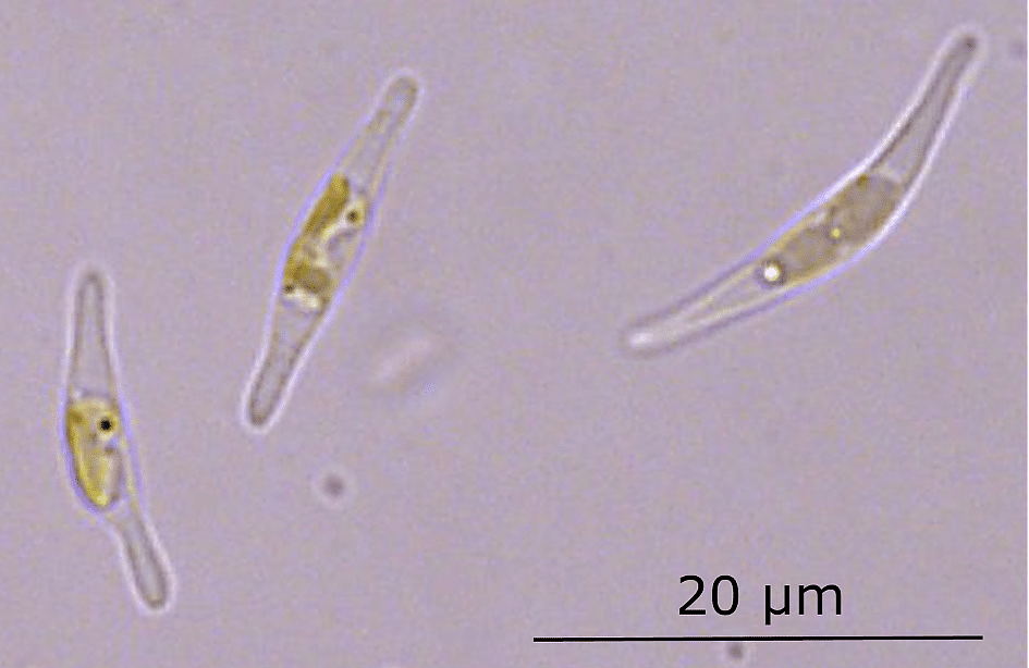 Les molécules formant l’huile sont hydrophobes. Dans le milieu aqueux de la cellule, ces dernières préfèrent donc se rassembler, cette concentration formant alors des gouttelettes d‘huile (ronds blancs sur l’image). Crédits : CEA